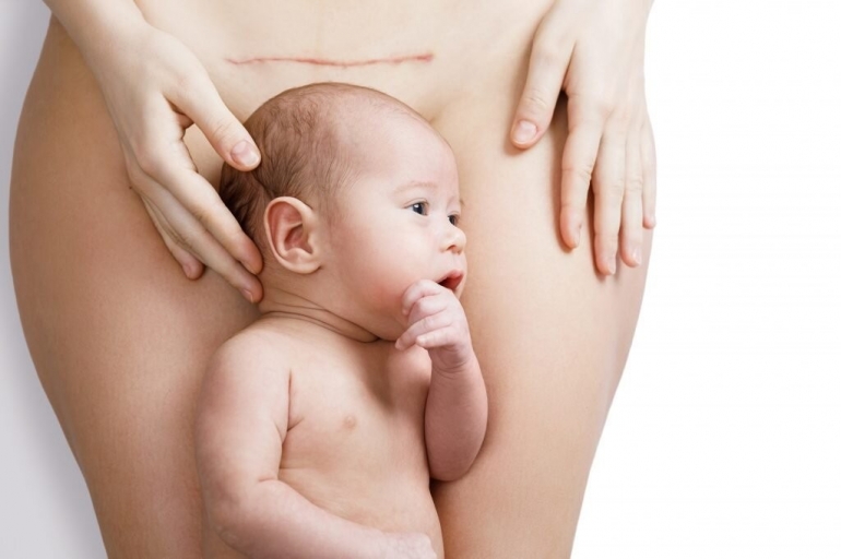 Cesarean-awareness-1024x682.jpg