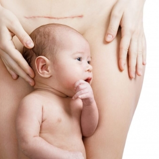 Cesarean-awareness-1024x682.jpg