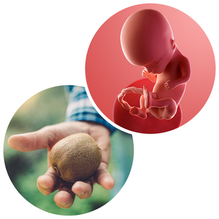 14tt-kiwi.png